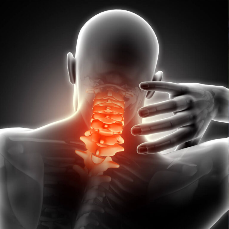 Vramar Health - Bolovi u Vratnoj Kralježnici